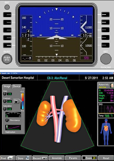 IGL Application and Uses